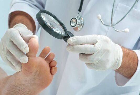 Fungal treatment
